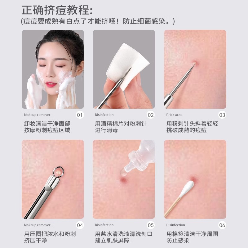 Ventas directas de alta aguja de acné cellular clip set salón de belleza herramientas de acné limpias pinzas ultra finas