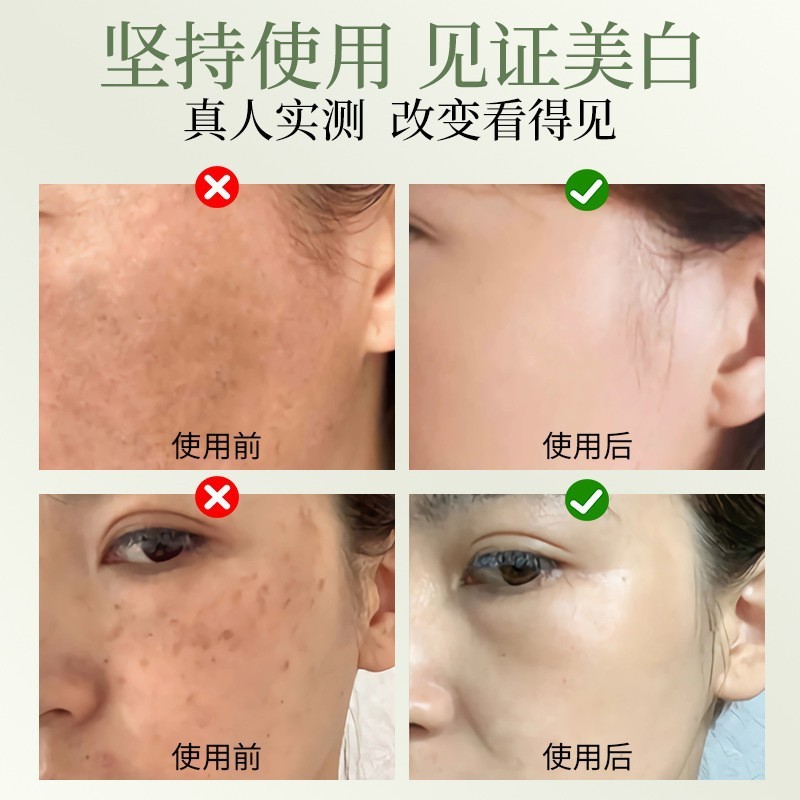 美容院专用强效控色霜绿膏绿霜点斑点痣技术后预防黑色素回流晚霜|undefined
