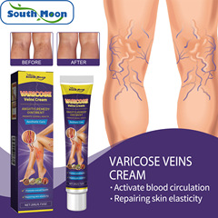South Moon Vein Relief Cream for Repairing Varicose Veins, Alleviating Leg Swelling, Pain, and Prominence