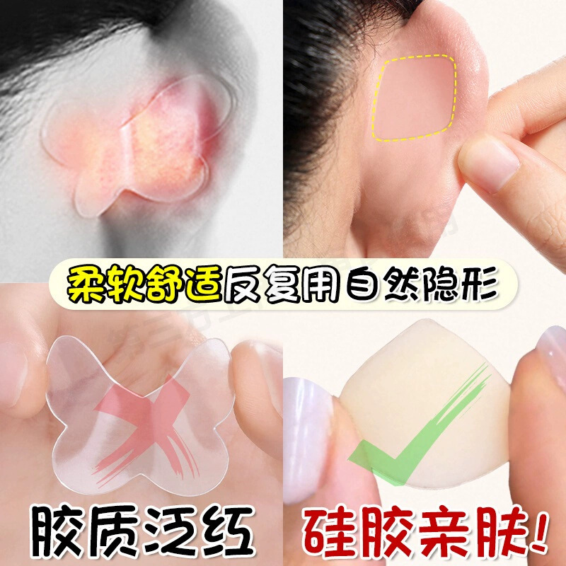 Chip Genie Ear Stickers Heterosexual Ear Ear Stickers Support Veer Correction Ear Invisible Face Display Keel Support
