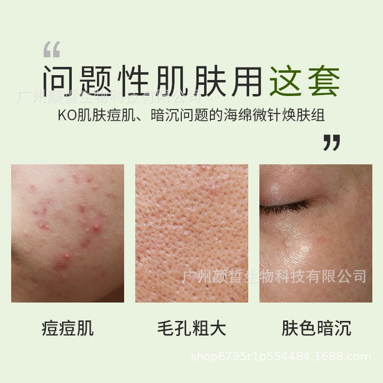 スポンジのマイクロニードルの美容院の専用の顔の看護の海藻の骨の針のスキンケアの箱の専門の庭の線の小さい緑の膜