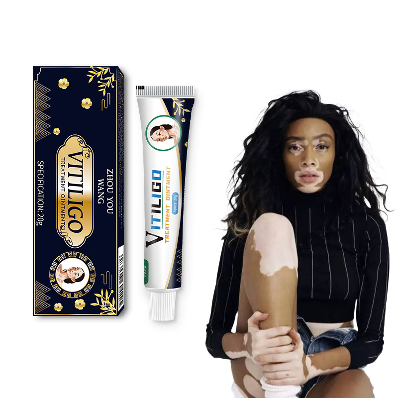 Белые пятна