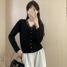 V�I�ٽzƴ���L��ᘿ���ë�·�ʽ���|����Ů�������e�ٴ�ᘿ��_��