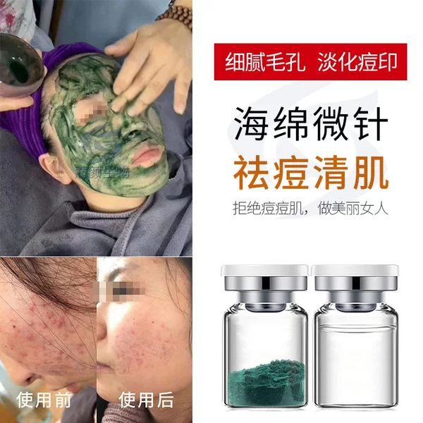 Sponge Micro-Needle Kit for Acne, Blackheads, and Pimples; Seaweed Silicone Needle Freeze-Dried Powder for Oil Control, Moisturizing, Anti-Wrinkle, and Pore Tightening