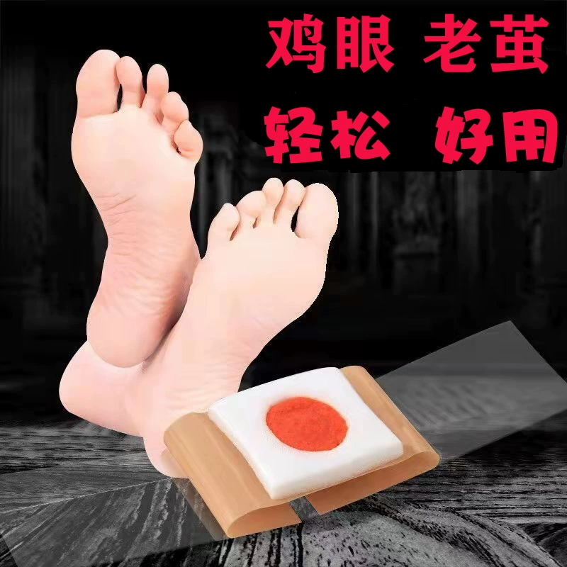 Оптовая продажа фабрики трансграничные поставки куриного глаза пасты куриный глаз крем готовый умирает оптом Вся коробка мульти-спецификации материальной модели