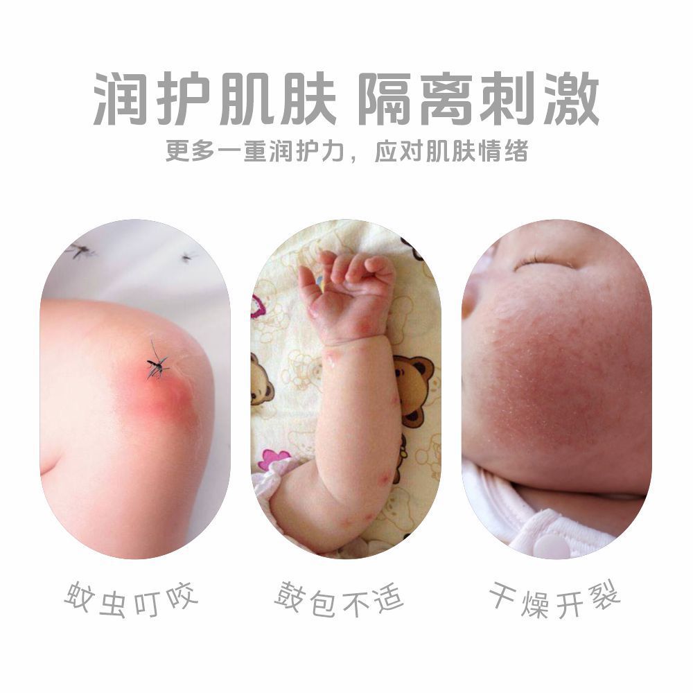 白雲山花城紫草膏寶寶艾草香膏膏蟲叮咬抑菌膏兒童舒緩止癢