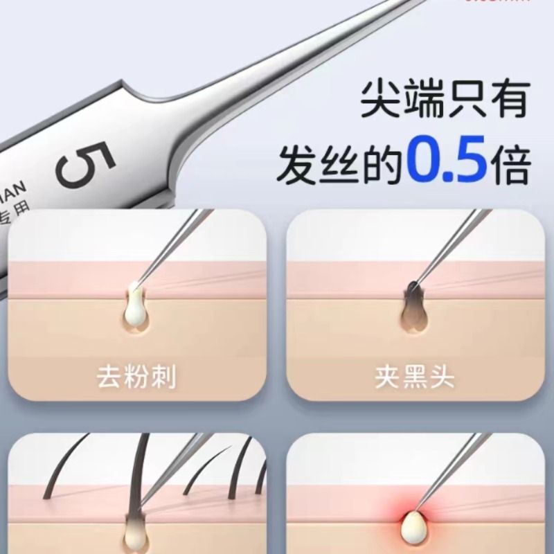 家用去黑头细胞夹子镊子粉刺针全套 美容专业不锈钢粉刺针4件套装|undefined