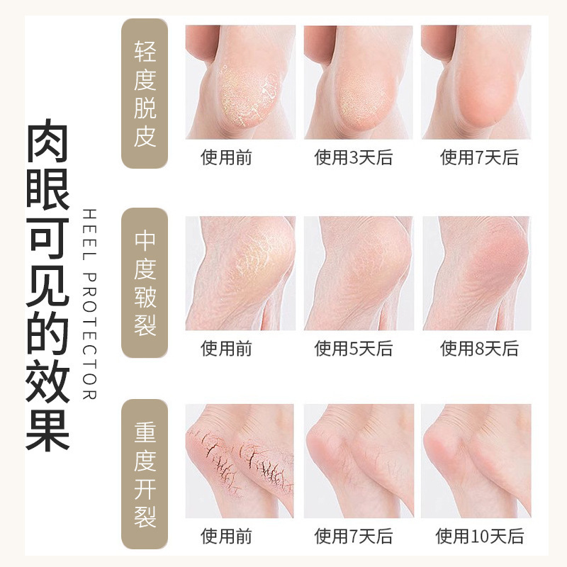 越境対応ひび割れ防止靴下、かかと保護カバー、シリコン製男女兼用フットケアソックス、保湿修復|undefined