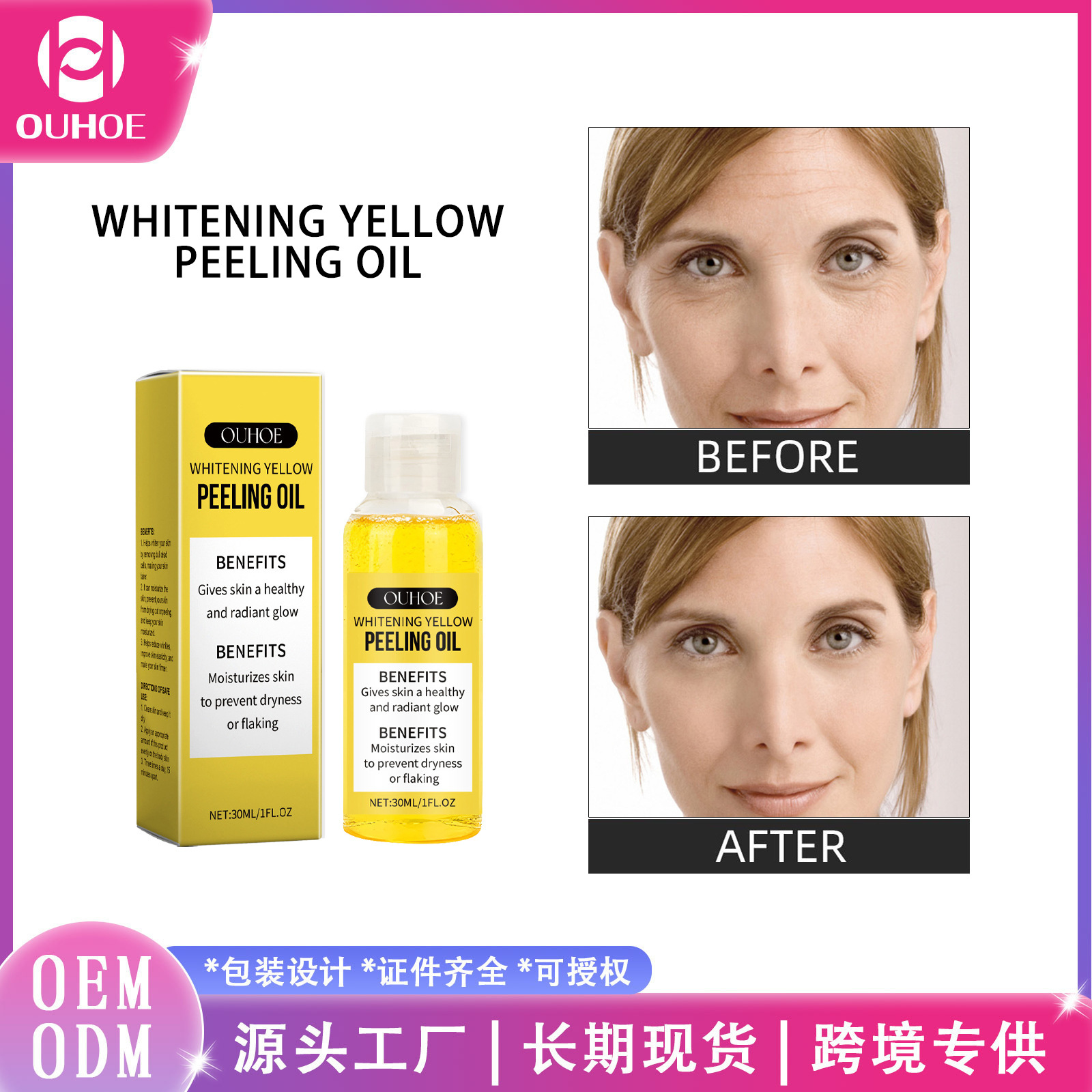 Ouhoe Care Yellow Skin Oil Softening Hydrating Moisturizing Care Silky Smooth Gentle Radiant Refreshing Comfortable Care Oil