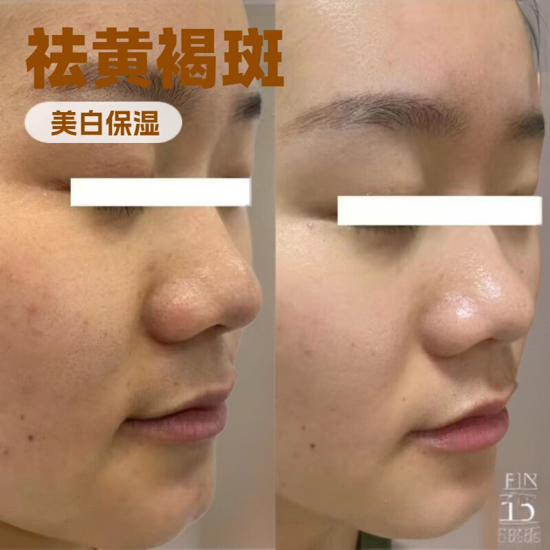臭臭水亮肤液美白调肤祛斑液美肌液排铅排汞祛黄褐斑靓肤液紧致|undefined