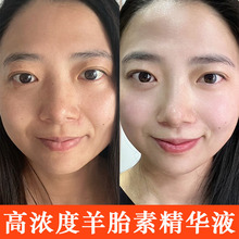 羊胎素精华液紧致抗皱淡化细纹补水保湿提拉青春定格抗老肌底原液