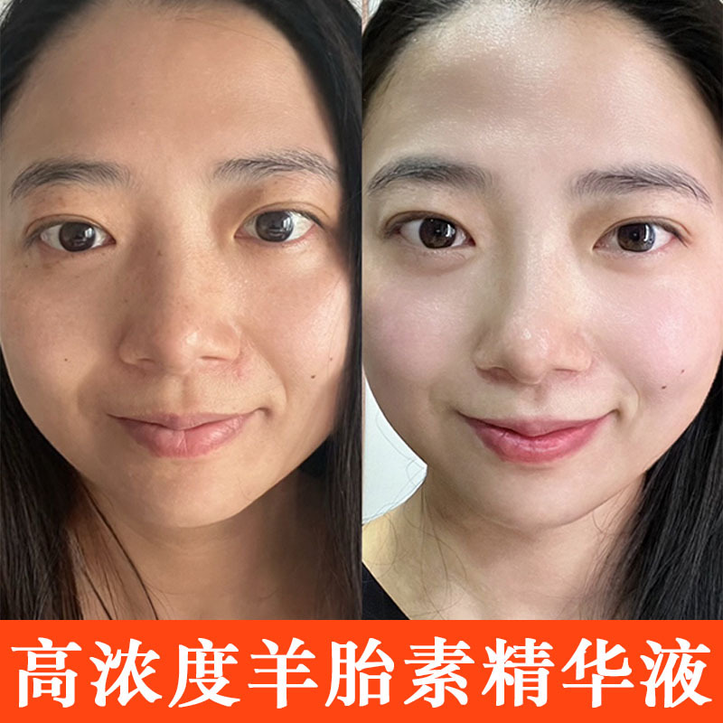 羊胎素精华液紧致抗皱淡化细纹补水保湿提拉青春定格抗老肌底原液