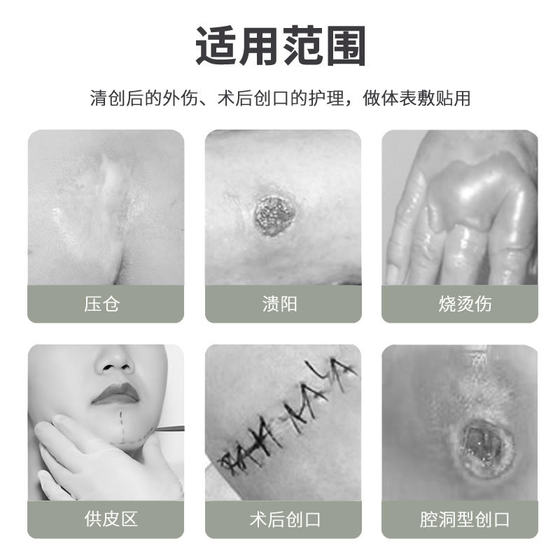 Hongsheng alginate dressing calcium alginate dressing wet filling functional dressing 10 * 10cm sterile application