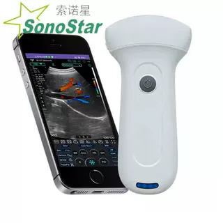 Sonostar索诺星厂家直销192阵元高配凸阵掌超 可定制询单问价