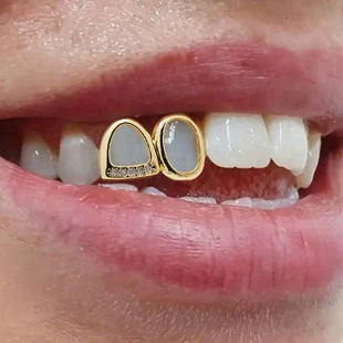 Зубные накладки двойные гладкие золочение 18K