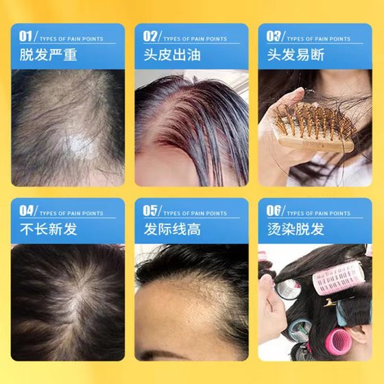 Nanjing Tongrentang shampoo 400ml strong hair oil control anti-dandruff biyande anti-hair care shampoo