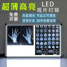 X���Ƭ��CT�˴Źǿƿ�Ƭ��led�^Ƭ���������p���^Ƭ��