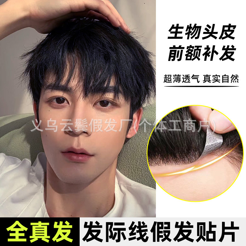 Hearline Wig Sticker for Men's Forehead Real Hair Replenishment Natural M-type Biological Scalp Forehead Traceless Wig