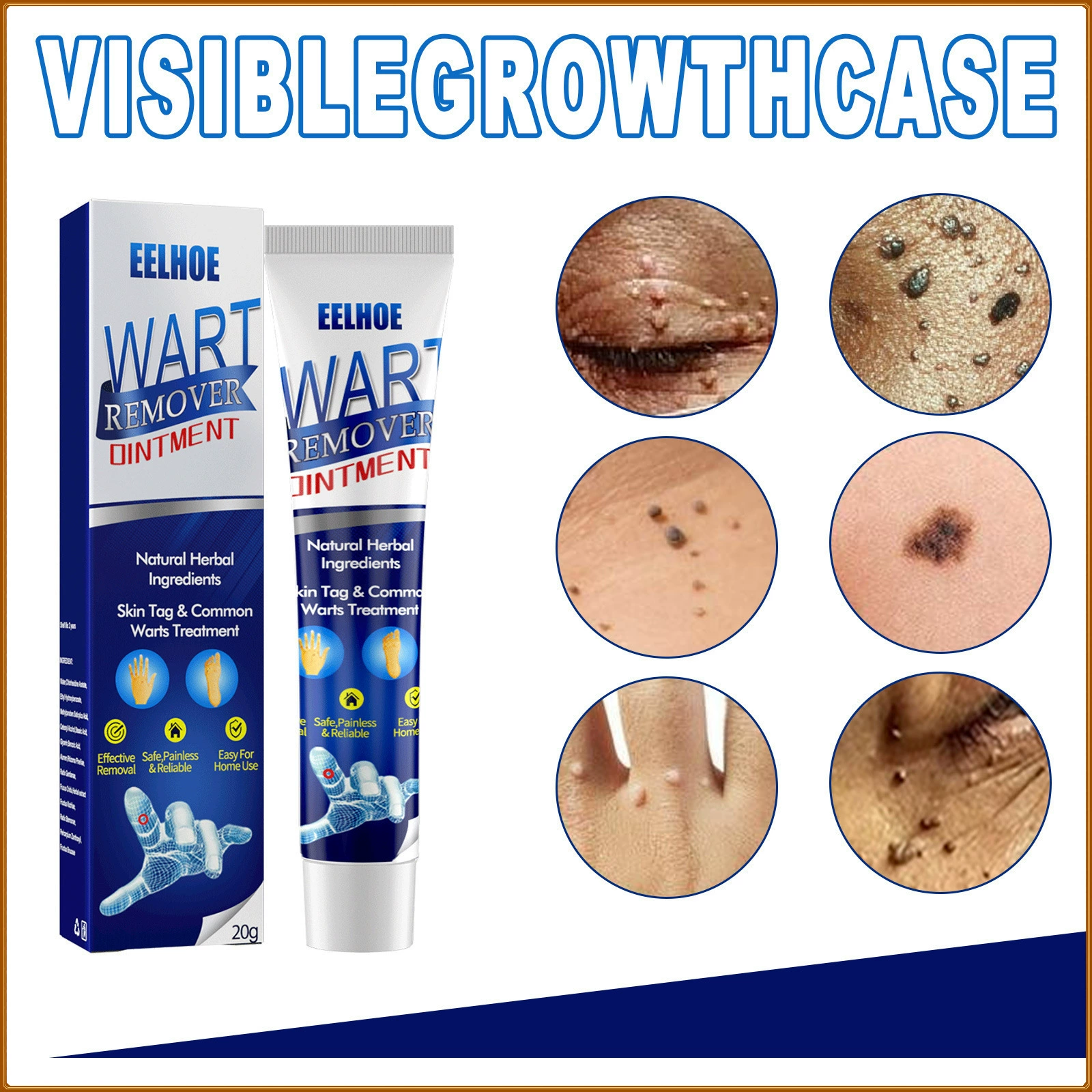 Eelhoe Antiwart cream паста бородавки для восстановления бородавки лица и шеи Подмышечные частицы мяса