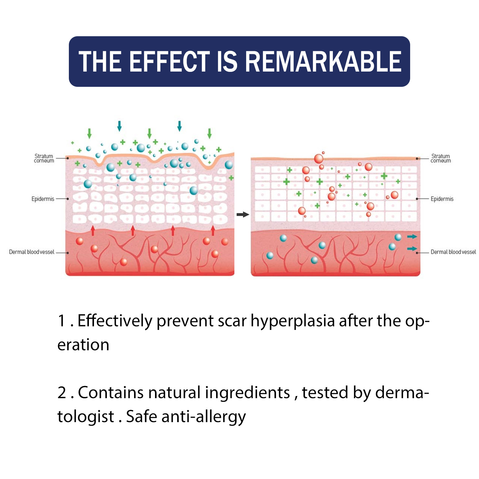 desalinizare reparare intervenție chirurgicală de sarcină cicatrice hiperplazie piele îngrijire arsură gel_voghion.com