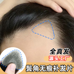 ヘアラインのかつらは男女全真髪鬢の角のかつらを貼って、額がはげているm型のヘアラインをカバーします。