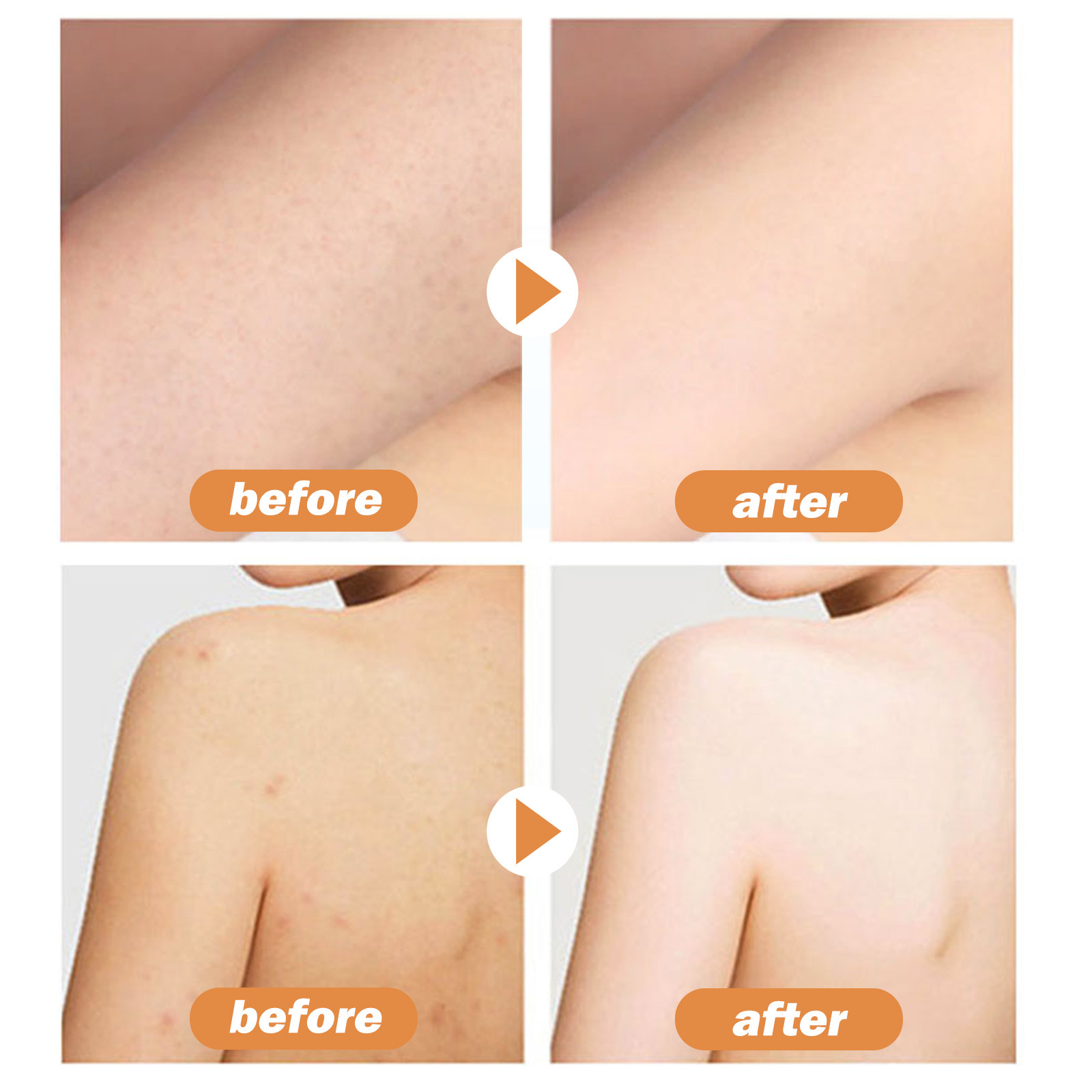 OUHOE Cocoa Butter Body lotion Lightens Acne Dark Skin, Moisturizes, Whitens and beautifies skin_voghion.com