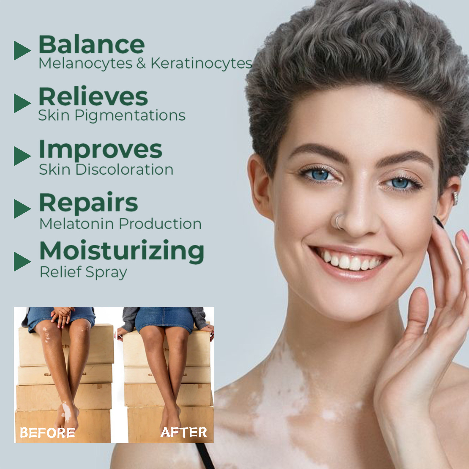 South Moon Vitiligo Beruhigende Creme Vitiligo Salbe Reparatur Vitiligo Flecken Haut Externe Pflege Salbe_voghion.com