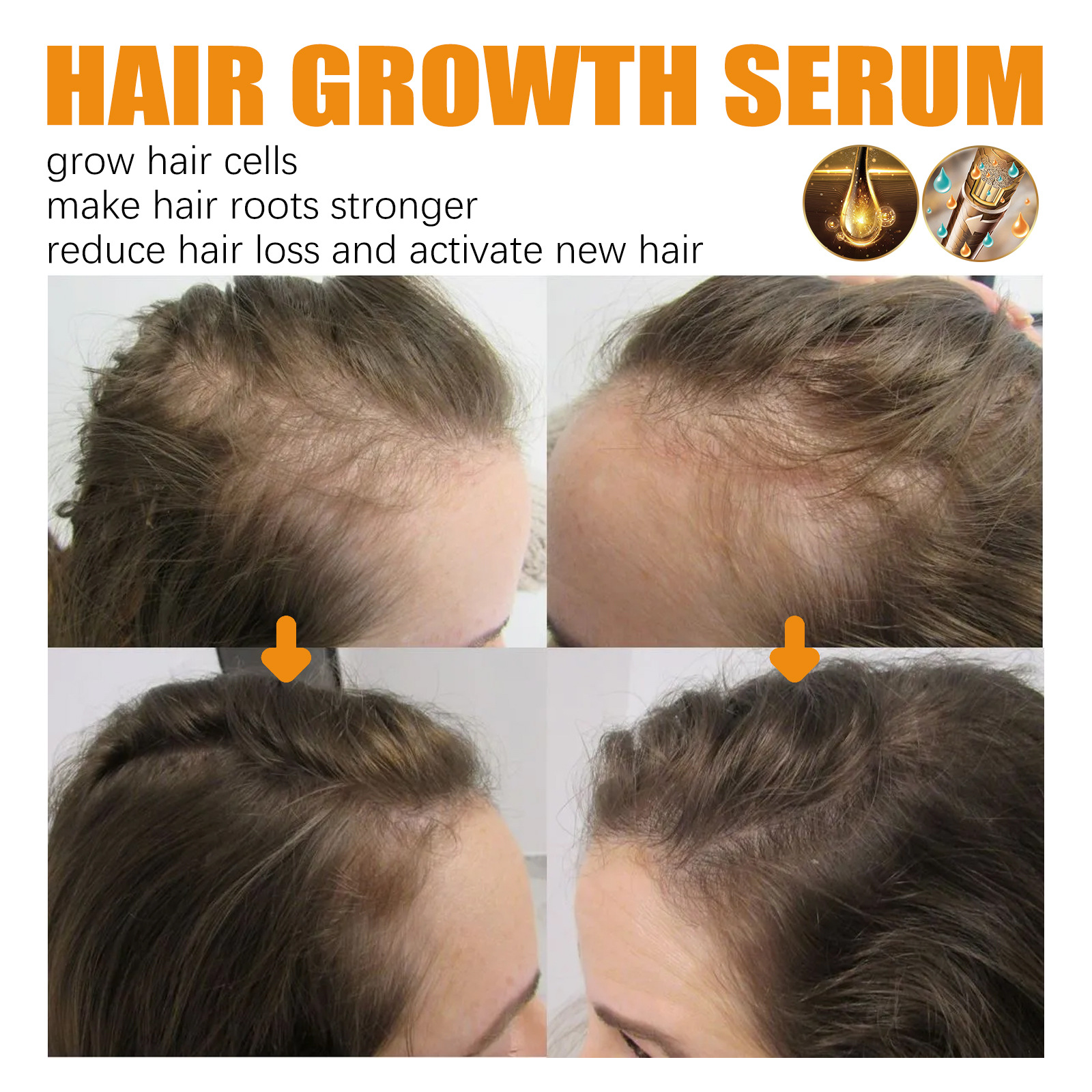 Spray capilar denso con biotina EELHOE, reparador y nutritivo para el cabello, cuidado del cabello, fortalecedor del cabello, spray antienvejecimiento para las raíces_voghion.com