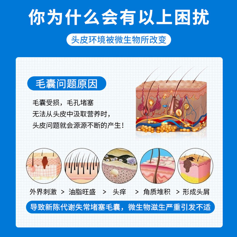 Zou Runan Chikang Wang Ketoconazole シャンプー、抗菌ローション、毛包洗浄、頭皮油ダニ、フケ、頭皮苔、さわやか|undefined