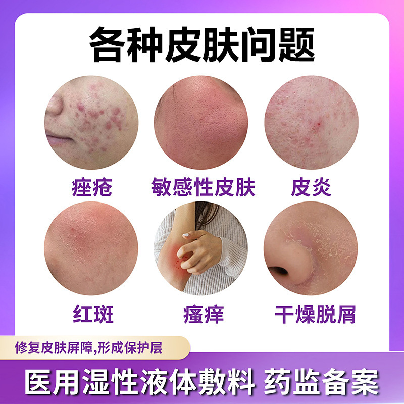 修正医療用湿潤液体包帯 30ml/本 メーカー直販卸売|undefined