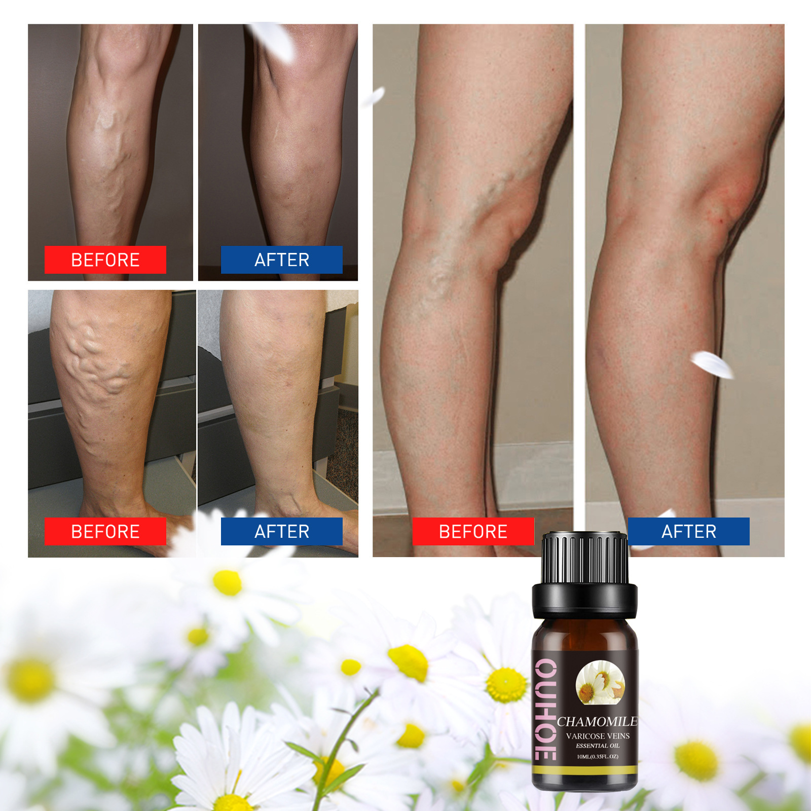 10 ml kummel eeterliku õli kehahoolduskomplekt lõõgastumiseks ja nahaks