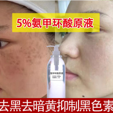 5%传明酸精华液高浓度氨甲环酸美白提亮去暗黄去黑色素祛斑液批发