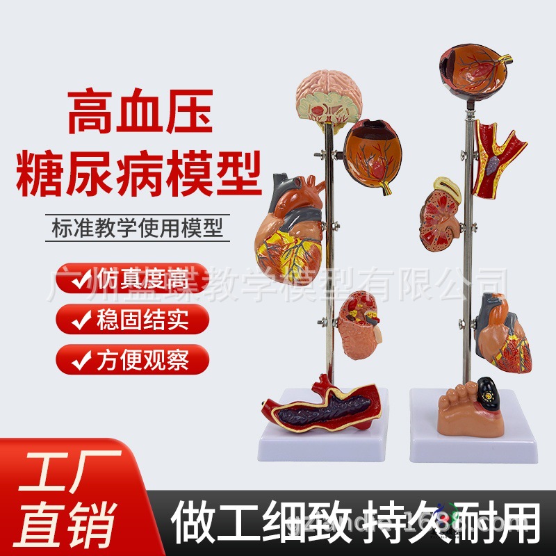 ��/Ѫѹģ�� ����/��������ģ�� ��̬������ ��Ѫѹ��������Ѫ��