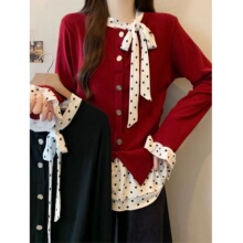 MR������ץë���ﶬ�OӋ�в��c����ᘿ����@�ݼӽq�Ӻ�ٴ�����