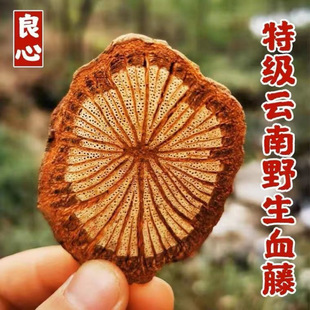 ���x��Ѫ����ș��ɢ�b�t�ٴ�Ѫͨ�tѪ�ٲ��XѪͨ��t�vһ���b���l