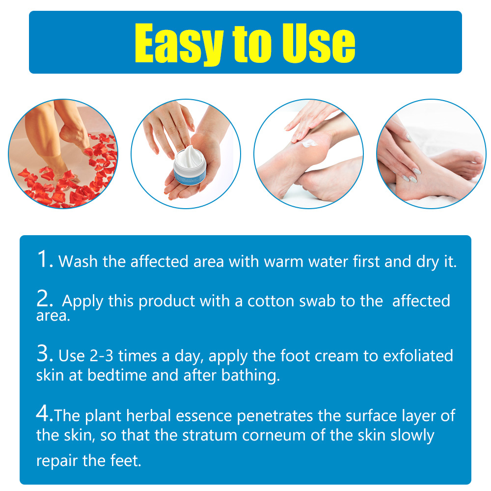 Foot Crack Sumifun Moisturizing Hand Cream Relieving Dry Skin Cracks 2024_voghion.com