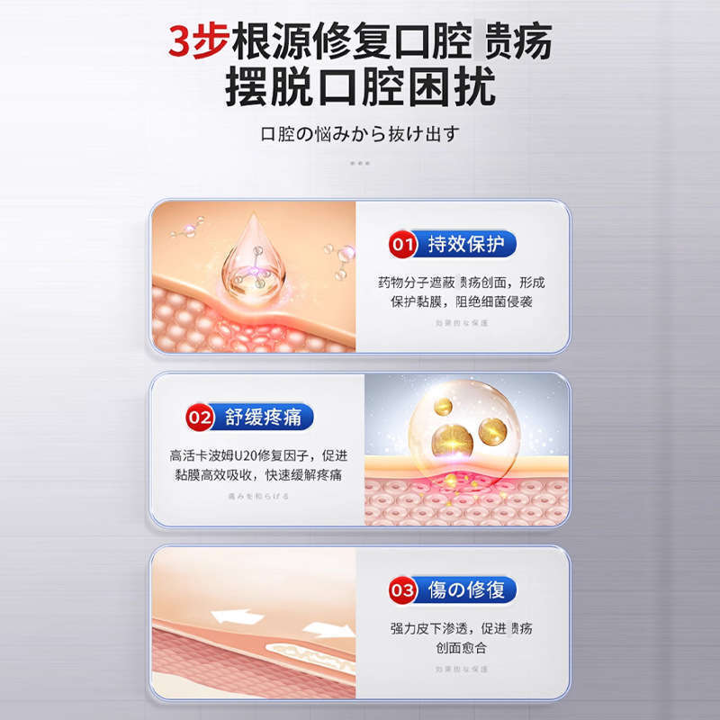 長い間、口腔の傷口を開発して修復してスプレーします。|undefined