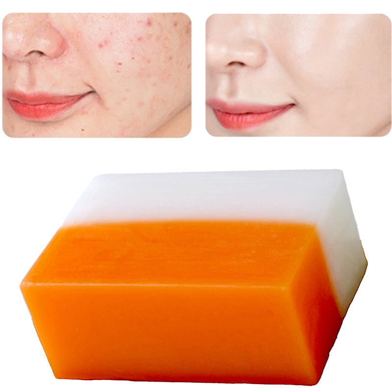 Crazylife Bicolor Kojic Acid Skin, Refreshes and Moisturizes the Face, Handmade Soap, Bathing Soap_voghion.com
