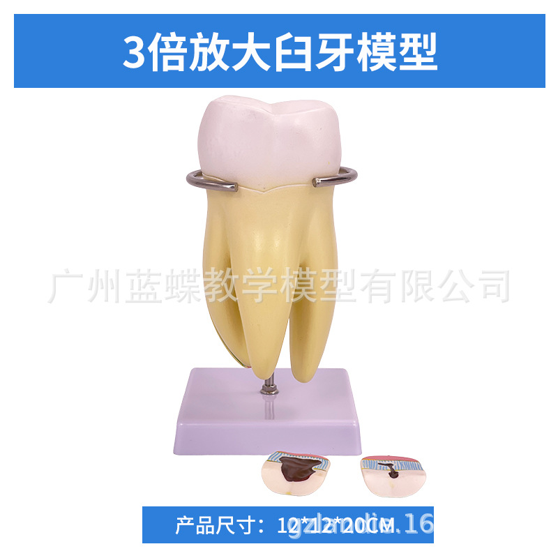 ���ƿ�ǻ�ı�ȣ�ݷֽ�ģ�� ����������ʾȣ�ݷ�չ���� ҽ����ͨ