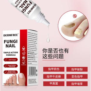 DERMFREE deashing bacteriostasis potent repair herbal formula mild non-irritating rapid penetration of onychomycosis liquid