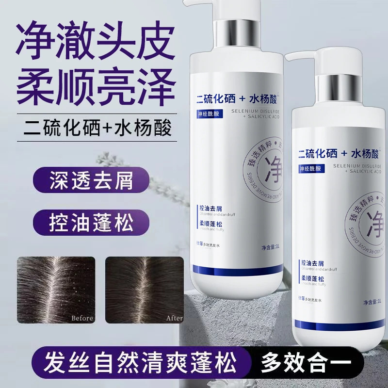 【一件代发】二硫化硒洗发水控油清爽蓬松去屑水杨酸洗头膏持久留|undefined