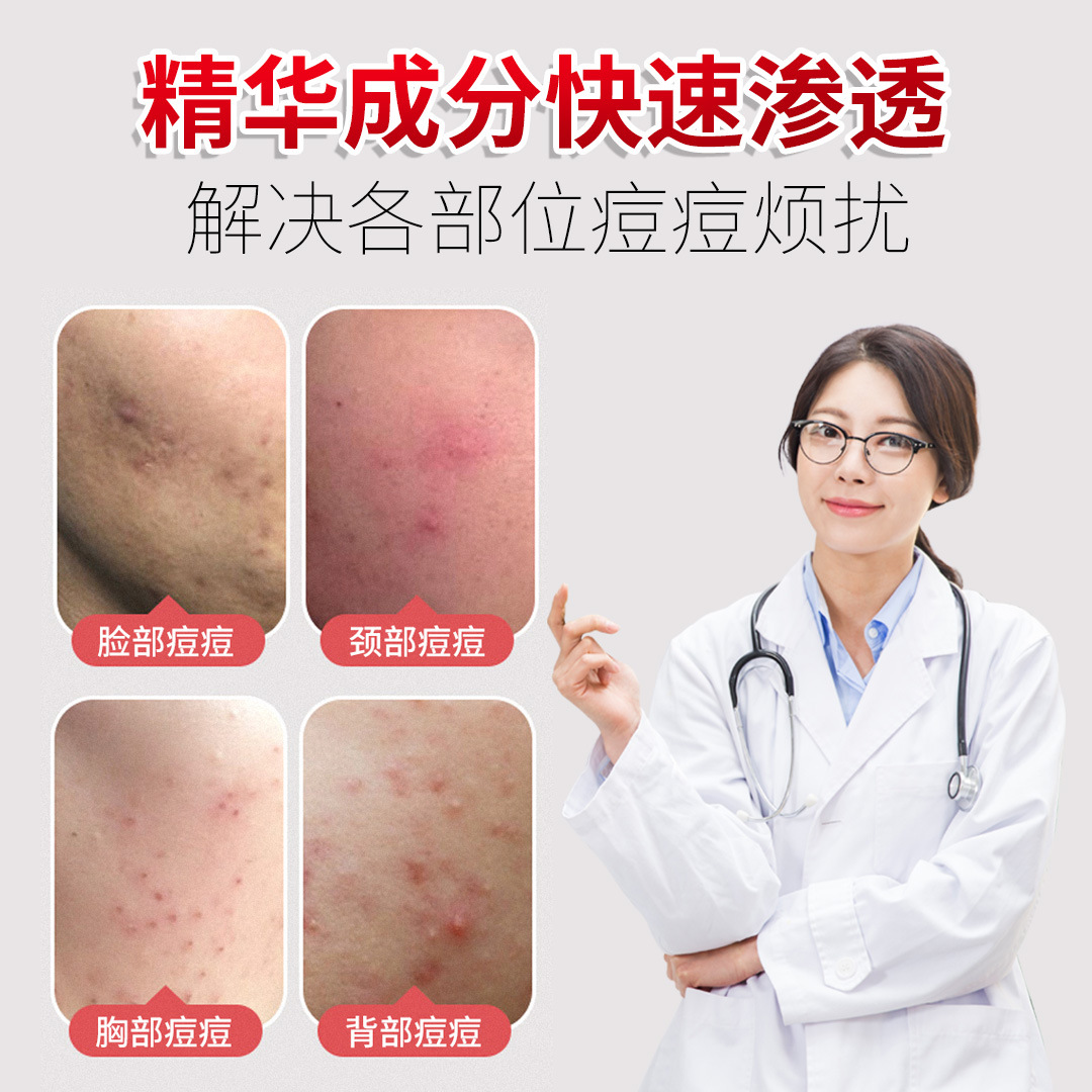 Tik Tok azelaic acid acne cream genuine acne muscle acne printing acne cream to cosmetics wholesale supply