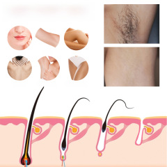 EELHOE Hair Removal Spray for Underarms - Gentle, Refreshing, Non-Irritating, Fine and Smooth Hair Removal Spray