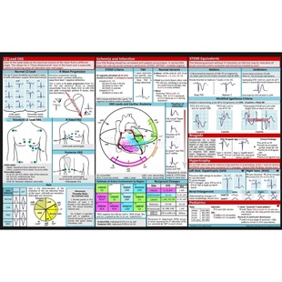 Cross-Border New Product Ekg Pocket Guide Ecg Pocket Guide