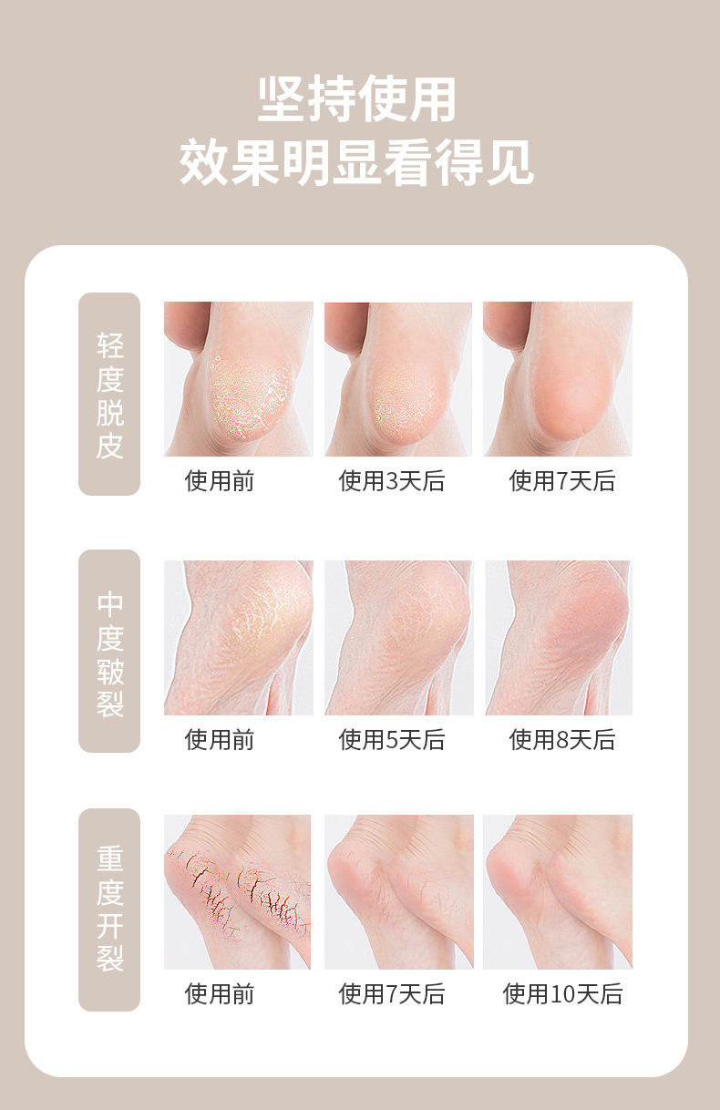 Cross-border anti-cracking sock, foot protection cover, anti-cracking and moisturizing socks, negative ion silicone heel socks pic 3