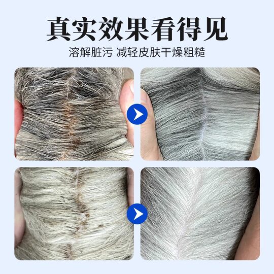 Oh pet pet chin cleaning bubble antibacterial deodorant black chin oil tail cat dog universal dry cleaning mousse