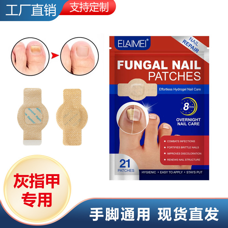 Paste de uñas grises transfronterizas para mejorar la infección Paste de cuidado de uñas Paste de protección de los dedos de los pies Paste de corrección anti-desgaste Paste de reparación de pies