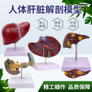仿真人体肝脏模型肝解剖模型肝胆胰脾十二指肠浮雕病变肝胆胰模型-阿里巴巴