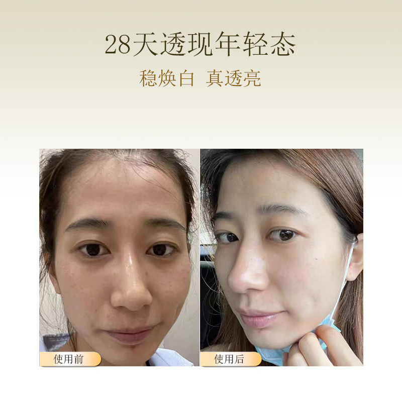 羊胎素精華液は老化保湿を遅らせて肌の色を明るくします。|undefined
