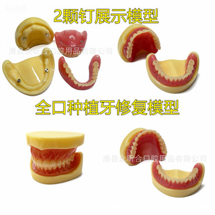 ����2�wᔻ���x�X��ģ�� �v��չʾȫ���x�X�����ͷNֲ�ޏͿɲ�ж